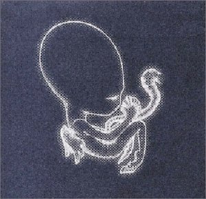 album sigur rs